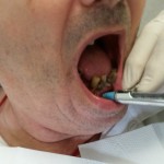 Soins dentaires en EHPAD