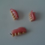 prothèse dentaire cassée